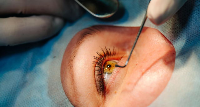 Surgery Restores Sight in Rare Eye Condition